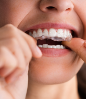 Patient holding up a dental shade guide guide to her teeth